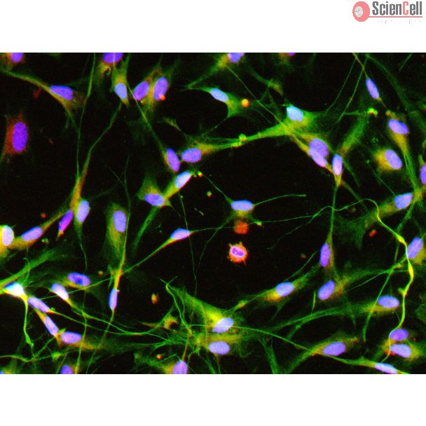 人多能干细胞衍生施旺细胞（HPSC-SC）- GFAP（红色）和S100β（绿色）免疫染色，200倍（200×）
