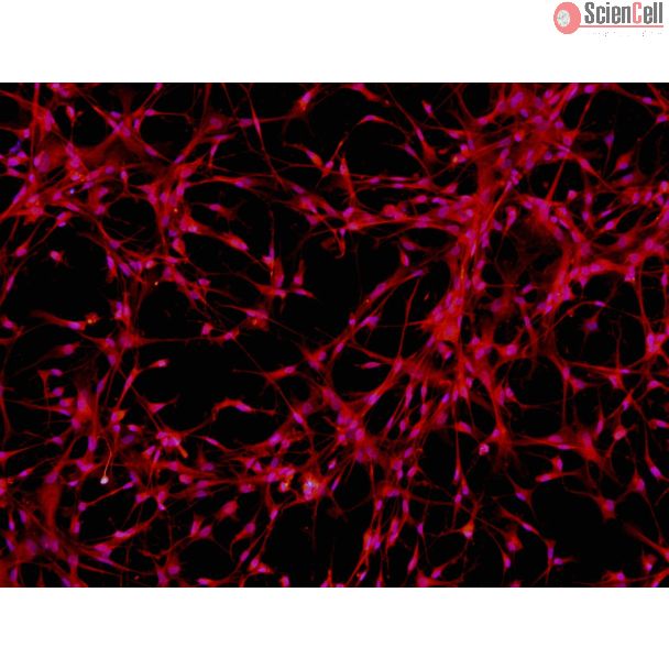 人多能干细胞衍生星形胶质细胞（H9-A）- GFAP免疫染色，200x。