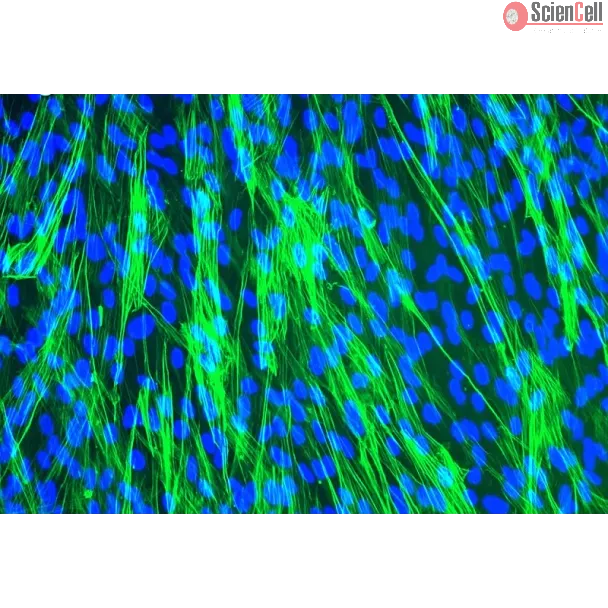 人类气管平滑肌细胞（HTSMC - Immunostaining for .
