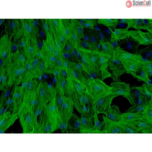 人肝星状细胞（HHSteC）— α-SMA 免疫染色，200×。