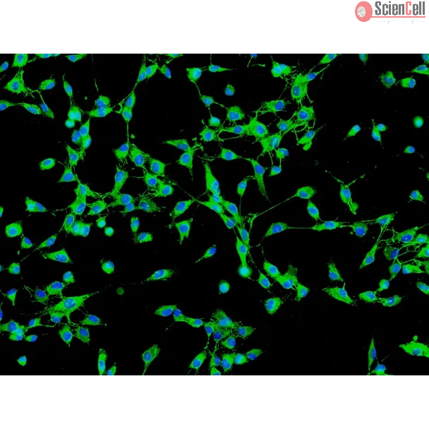 人胆囊成纤维细胞（HGBF）- 纤维连接蛋白（Fibronectin）免疫染色，200×
