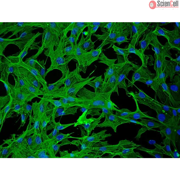 兔肝星状细胞（RabHSteC）— α-平滑肌肌动蛋白（α-SMA）免疫染色，200×倍率。