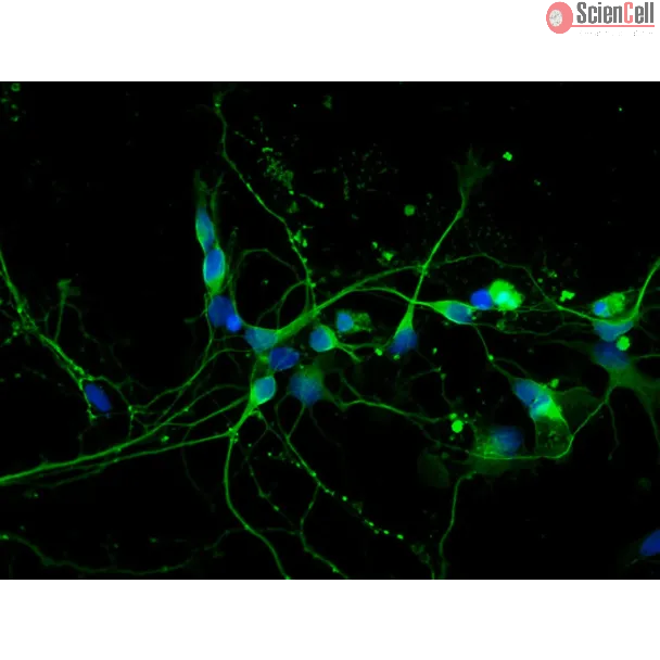 大鼠中脑神经元（RN-mb）——β-tubulin III 免疫染色，400×。