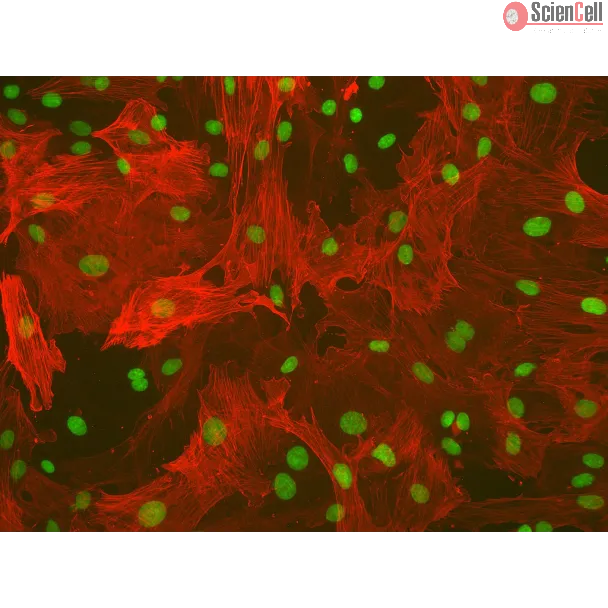 大鼠肝星状细胞（RHSteC）α-SMA 免疫荧光染色，200×
