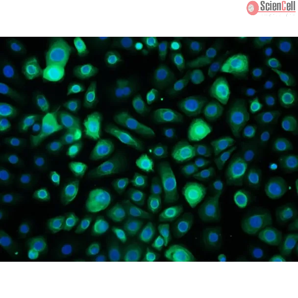 成人人支气管上皮细胞（HBEpiC-a）- 细胞角蛋白 18（CK-18）免疫染色，200×。
