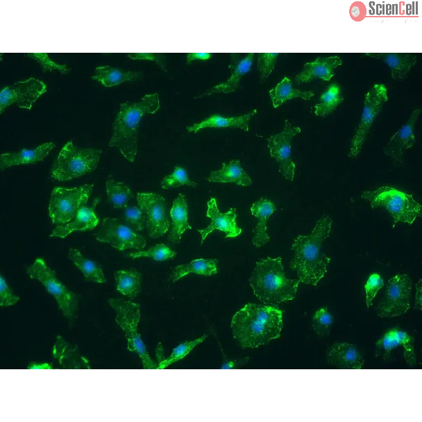 小鼠脾脏巨噬细胞（MSMa）——CD11b免疫染色，400×
