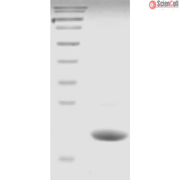 重组人 UbE2G2