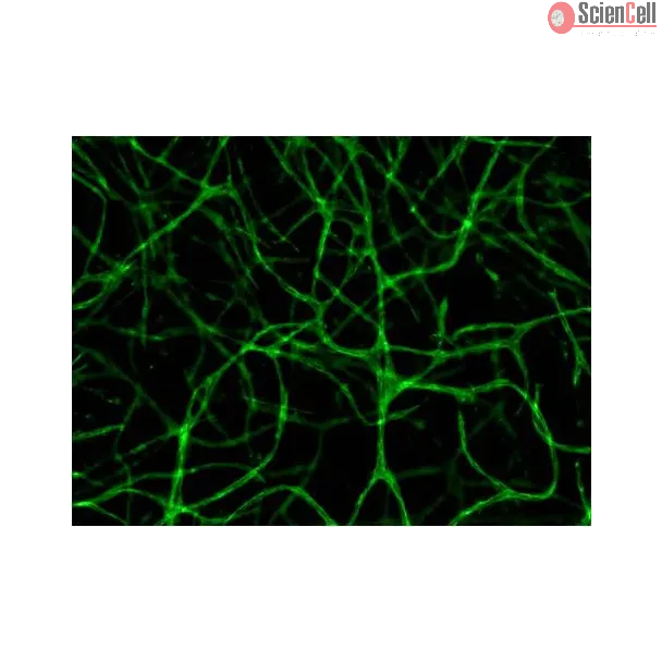 Resultant endothelial tubules from Cat 8728 stained with CD31 using this 3D Gel Staininig Prep Kit