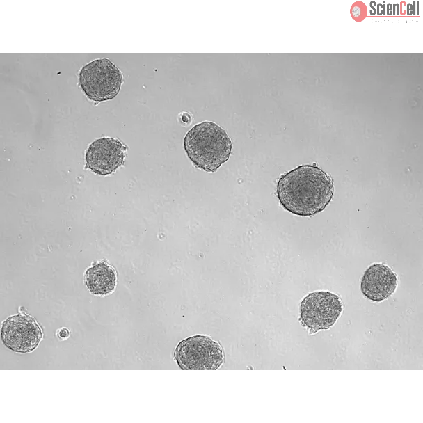 Development of 3D osteoblast spheroid at days 3 (taken at 100x magnification). 