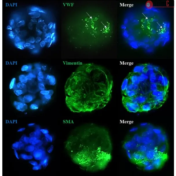 Immunostaining of the co-culture spheroids with the stellate cell markers (Vimentin and Smooth Muscle Actin) and the endothelial cell marker Von Willebrand Factor.