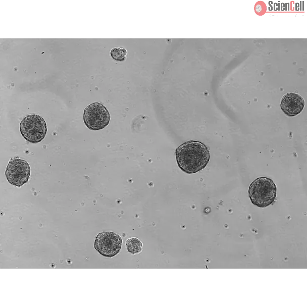 Day 5: Osteoblast and endothelial cells co-culture spheroids