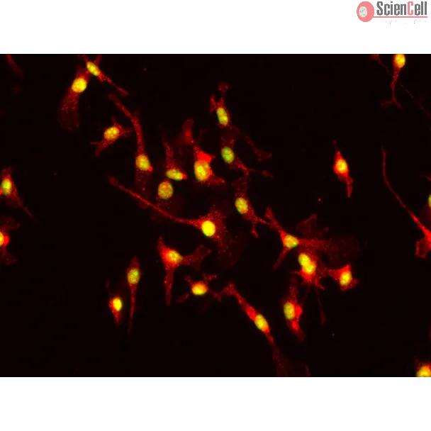 小鼠肝巨噬细胞（MHMa）F4/80 免疫染色，400×
