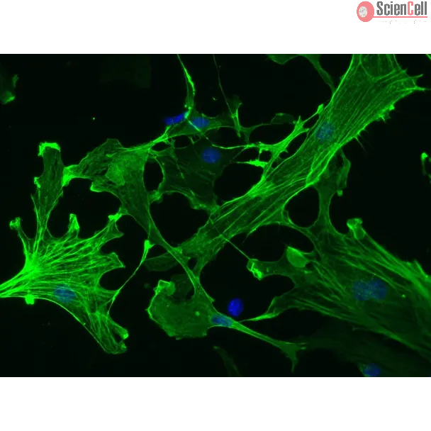 小鼠肝星状细胞（MHSteC）α-SMA 免疫染色，200×
