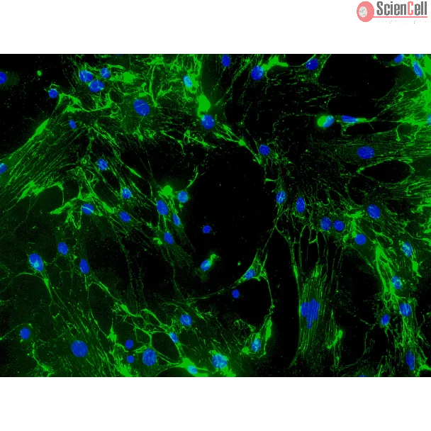 CD1 小鼠心脏成纤维细胞（MCF）- 纤维连接蛋白（Fibronectin）免疫染色，200×。