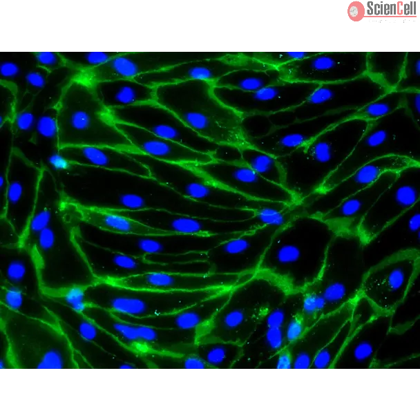 HiPSC-Derived Endothelial Cells (HiPSC-EC) -
Immunostaining for CD31, 200x
