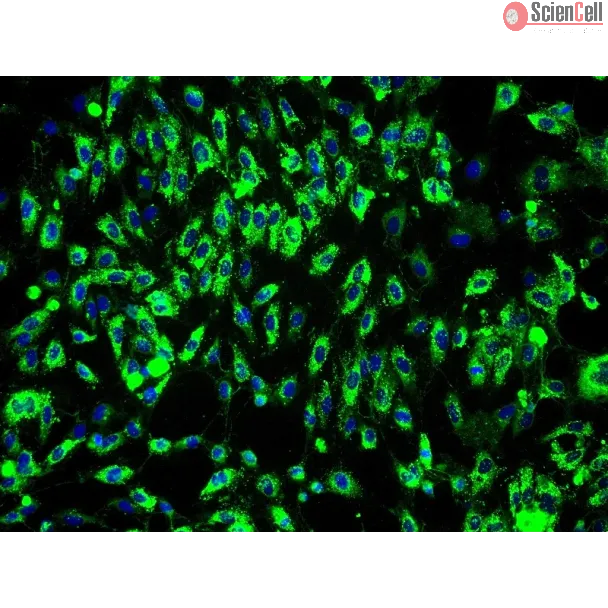 Human Bladder Microvascular Endothelial Cells (HBdMEC) - Immunostaining for vWF, 200x.
