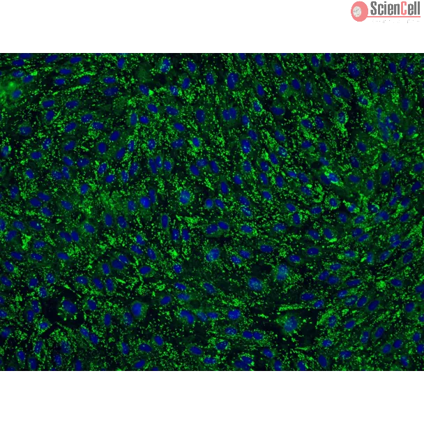 Human Cervical Microvascular Endothelial Cells (HCerMEC)-Immunostaining for vWF, 200x
