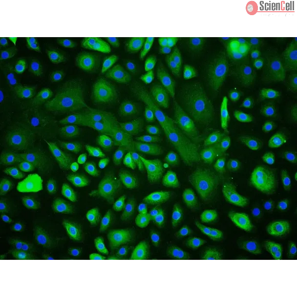 Human Corneal Epithelial Cells (HCEpiC) - Immunostaining for CK-18, 200x.
