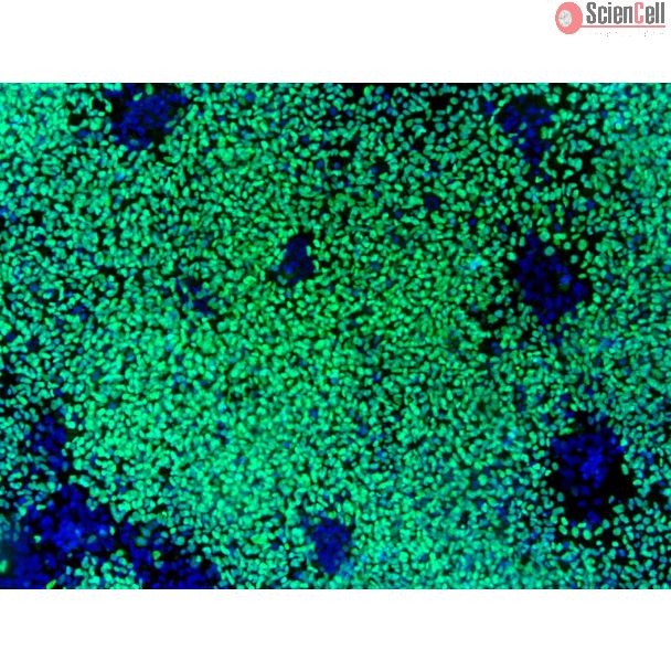 HiPSC-Derived Neural Crest Cells (HiPSC-NCC) - Immunostaining for SOX10, 100x