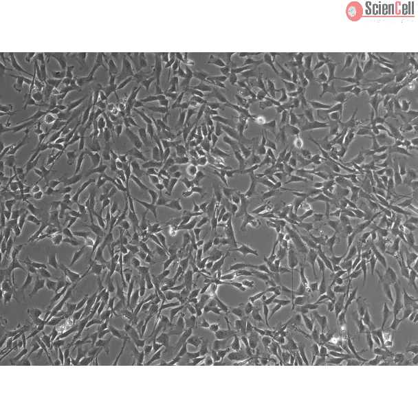 Human Leptomeningeal Pericytes (HLP) – Phase contrast, 100x
