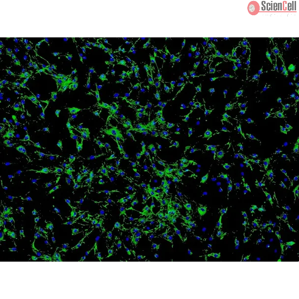 Human Ocular Choroid Fibroblasts (HOCF) - Immunostaining for Fibronectin, 100x.
