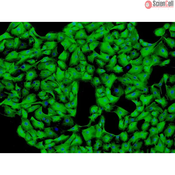 Human Seminal Vesicle Epithelial Cells (HSVEpiC) - Immunostaining for CK-18, 100x.
