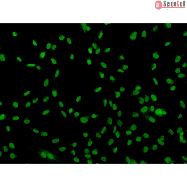 Human Sertoli Cells (HSerC)-Immunostaining for SOX-9, 200x.
