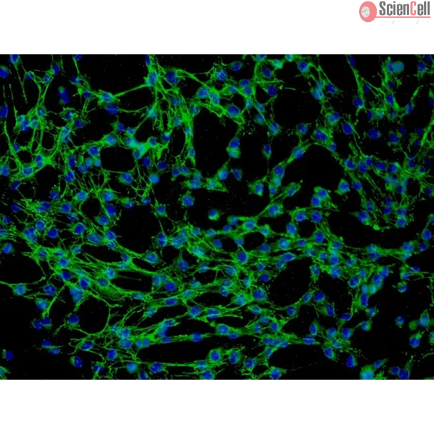 Human Thymic Fibroblasts (HTyF) - Immunostaining for Fibronectin, 200x.
