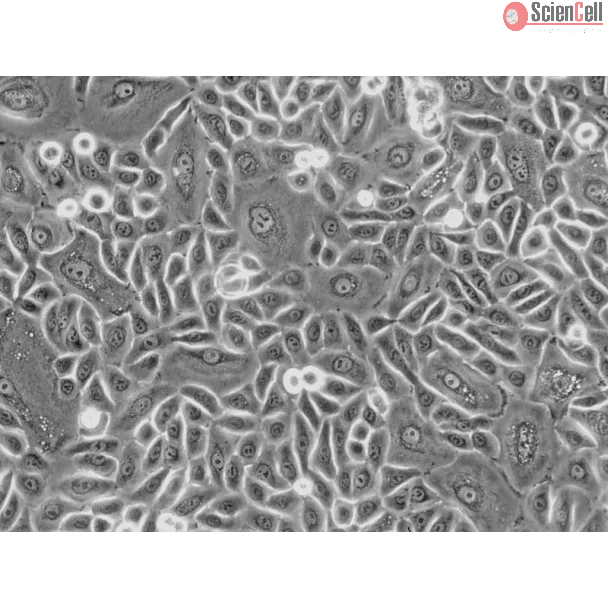 Human Tonsil Epithelial Cells (HTEpiC) - Phase contrast, 200x.

