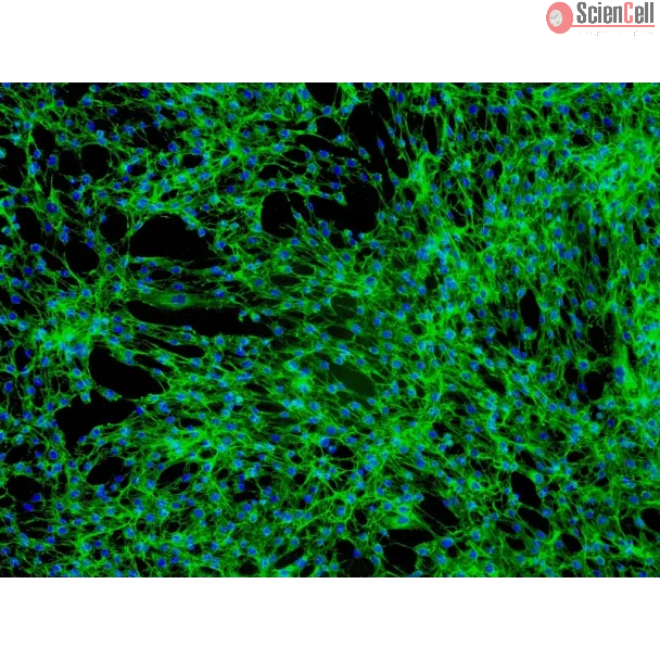 Human Tonsil Fibroblasts (HTF) - Immunostaining for Fibronectin, 100x.
