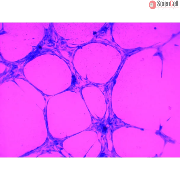 In Vitro Tube Formation Assay