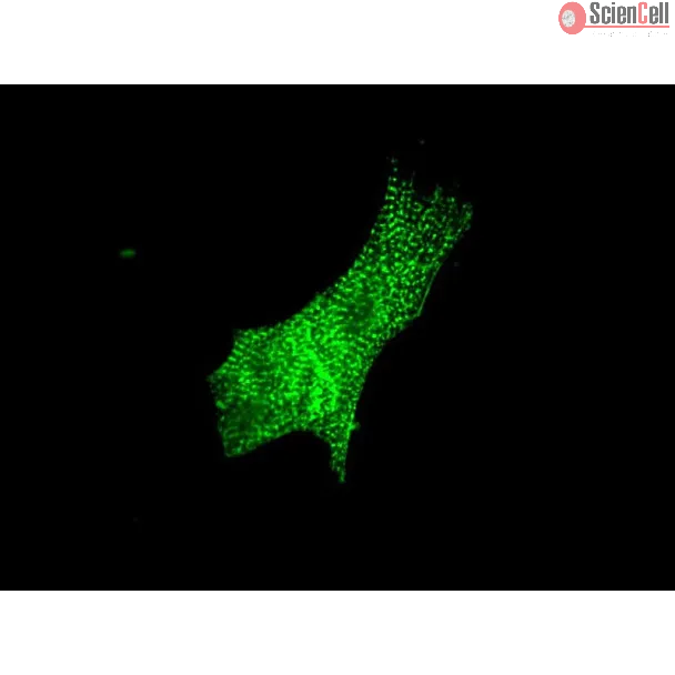 Mouse Cardiac Myocytes (MCM) – Immunostaining for Sarcomeric alpha-Actinin (Boster, Cat #MA1104)
