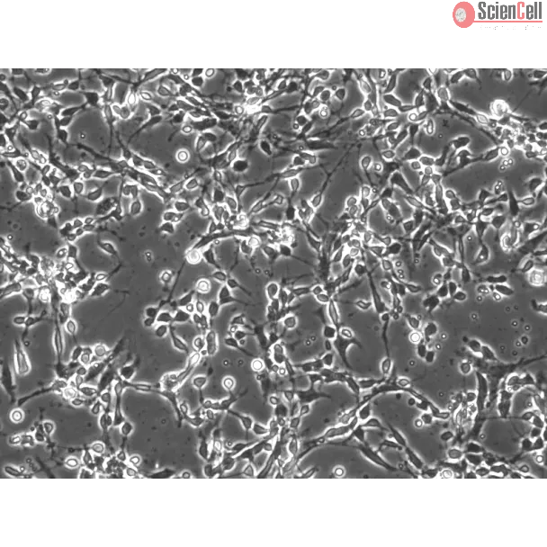 Mouse Cerebellar Granule Cells (MGC) - Phase contrast, 200x.
