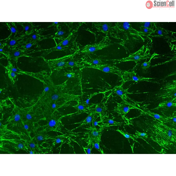 Mouse Lymphatic Fibroblasts (MLF) – Immunostaining for Fibronectin, 200x

