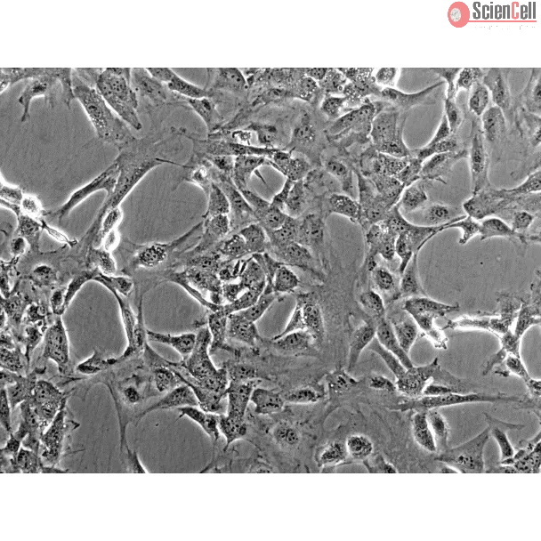 Mouse Meningeal Cells (MMenC) - Phase contrast, 200x.
