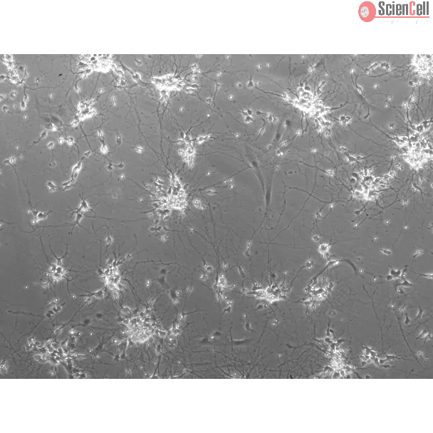 Mouse Neurons-striatal (MN-s) - Phase Contrast, 100x