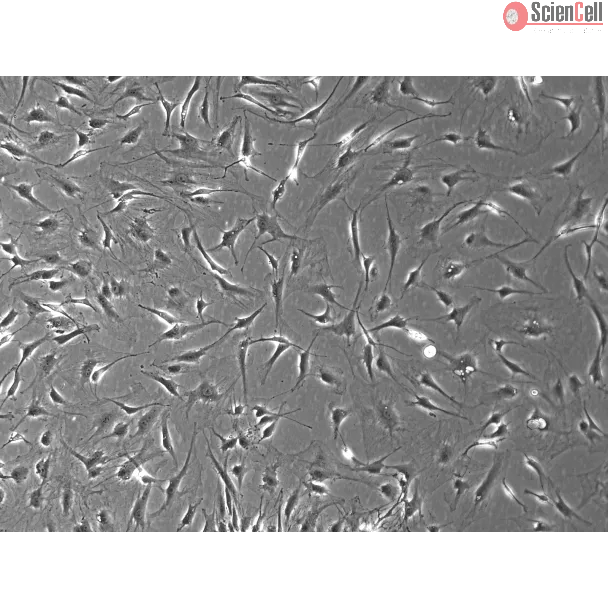 Rat Dermal Fibroblasts-adult (RDF-a) - Phase Contrast, 100x.
