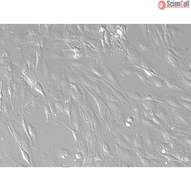 Rat Hepatic Stellate Cells-adult (RHSteC-a)-Relief contrast, 200x.
