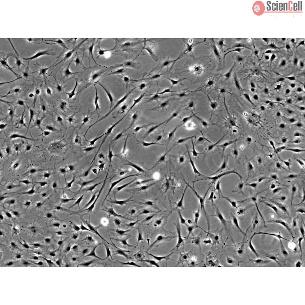 Rat Keratocytes (RK) - Phase contrast, 100x.
