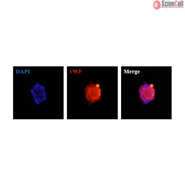 Human Hepatic Sinusoidal Endothelial Cell Spheroids express the endothelial cell marker von Willebrand factor (vWF). 