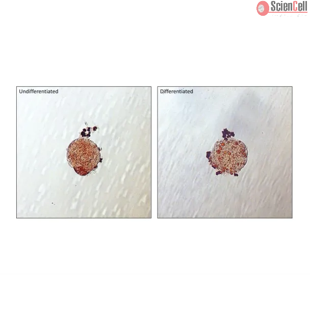 Lipid droplets are visible in Human Preadipocyte spheroids after 5 days of culture in differentiation medium