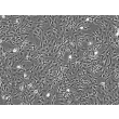 小脑星形胶质细胞 (HA-c) - 相差显微成像，200x。