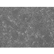 人类星形胶质细胞-海马（HA-h）- 相差显微镜，100倍放大。