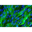 人类肺动脉平滑肌细胞 [HPASMC] - α-SMA 的免疫染色，400倍