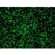 Human Adipose Microvascular Endothelial Cells (HAMEC) - Immunostaining for vWF, 100x.

