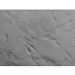 Human Bronchial Fibroblasts (HBF) - Relief contrast, 400x.
