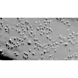 Human Coronary Artery Endothelial Cells (HCAEC) - Relief contrast, 100x.