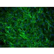 Human Dermal Fibroblasts-fetal (HDF-f) - Immunostaining for Fibronectin, 200x.
