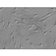 Human Epidermal Melanocytes-medium (HEM-m) - Relief contrast, 400x.
