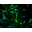 Human Epidermal Melanocytes-medium (HEM-m) - Immunostaining for S100-β, 400x.
